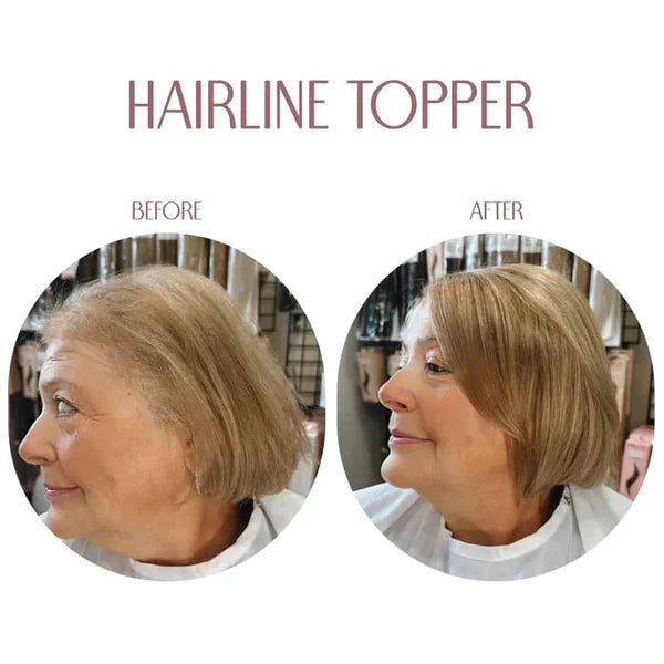 Hairline Band –Limited Edition,Upgrade Your Look Today!🔥