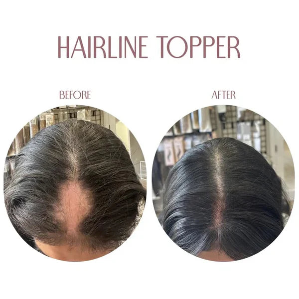 Hairline Band –Limited Edition,Upgrade Your Look Today!🔥